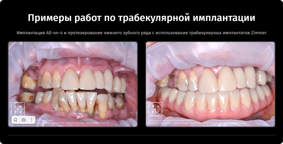 Скриншот с сайта. Примеры «до» и «после» мы добавили для потребителей, которым важна  «работа» услуги — эстетичный вид