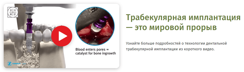 Блоки с рассказом о технологиях помогают создать образ современной, инновационной клиники