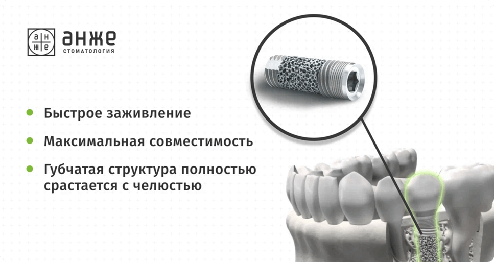 Выстраиваем единое позиционирование в разных точках контактах с аудиторией: в рекламе, на сайте, в социальных сетях