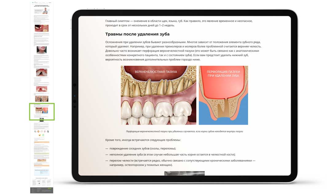 Подробная статья с советами от основателя клиники, которая отвечает на все вопросы пациента Портфолио стоматология Денити